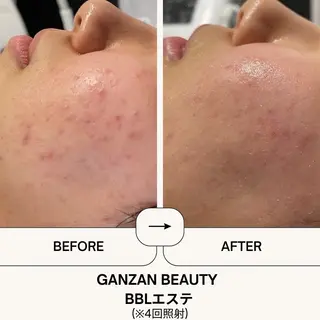ganzan beauty所属・GANZAN yukariのエステ・リラクイメージ