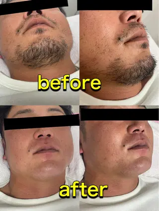 LeaLea_K MIZUKIのマツエク・マツパデザイン