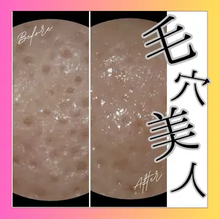 メナード　フェイシャルサロン　鳥飼野々店所属・石川 捺季のエステ・リラクイメージ