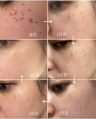 AnLimit 當山杏奈のエステ・リラクイメージ