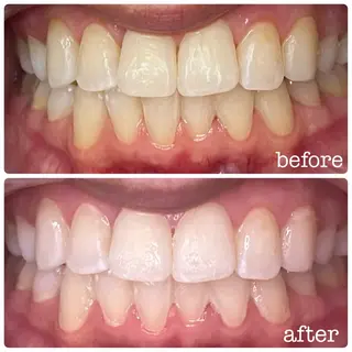 DH. MISATOの眉毛・アイブロウイメージ