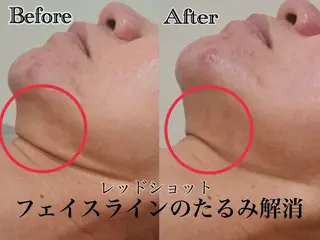 六本木脱毛andS 店長Sachiのエステ・リラクイメージ