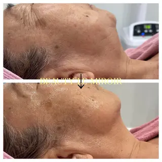 ビューティー ミロワールのエステ・リラクイメージ