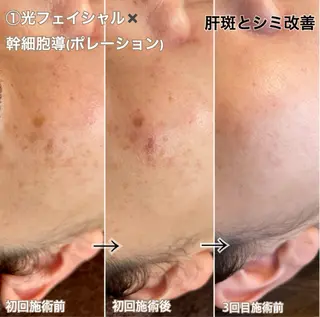 LAESSE 恵比寿所属・毛穴と美白の専門店 LAESSE 恵比寿のエステ・リラクイメージ