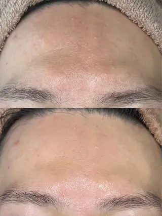 ebcs 8のエステ・リラクイメージ