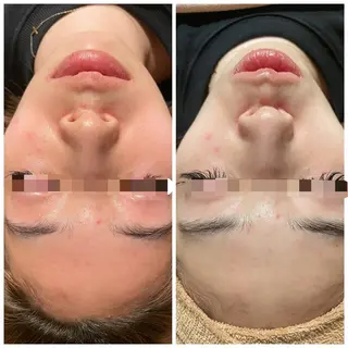 Shelly Graceのエステ・リラクイメージ