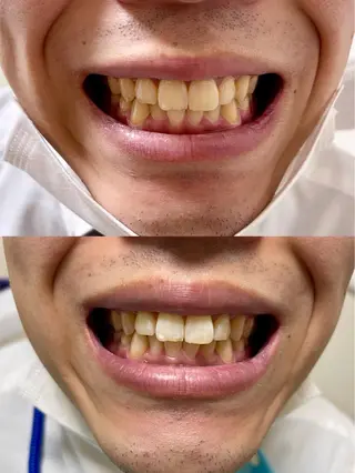 salon:S 仙台店のマツエク・マツパデザイン