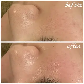 メンズ メナード岐阜市茜部 杉浦のエステ・リラクイメージ