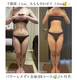 biloop所属・《本気痩せ×疲労改善 》  BILOOPのエステ・リラクイメージ