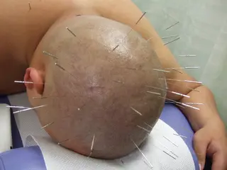 銀座そうぜん鍼灸院所属・不妊鍼灸専門 吉田ナミのエステ・リラクイメージ