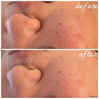 メンズ メナード岐阜市茜部 杉浦のエステ・リラクイメージ