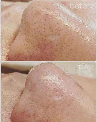 Lilld eyelash大井町のマツエク・マツパデザイン