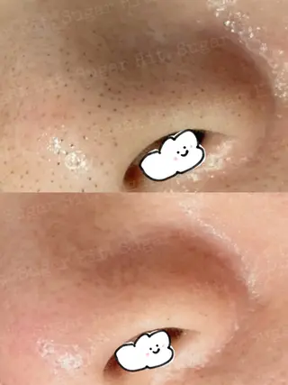 Hit. シュガーリング豊橋のエステ・リラクイメージ