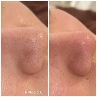 💚THE BALM 金子💚✨のエステ・リラクイメージ