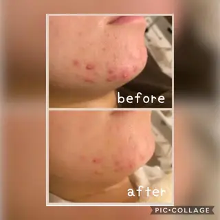 美肌蘇生カウンセラー 横山りえのエステ・リラクイメージ