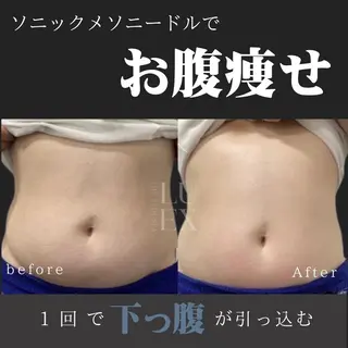 痩身専門サロン Saoriのエステ・リラクイメージ