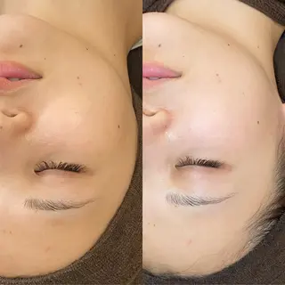 Écrinna所属・Écrinna eyelashのマツエク・マツパデザイン