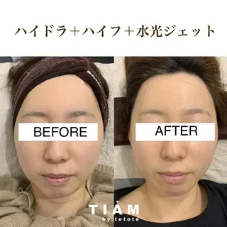 美肌サロンTIAM by tetoteのエステ・リラクイメージ