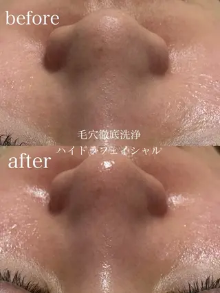 フェイシャルサロン CHIARA鈴木のエステ・リラクイメージ