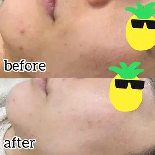 laluna saki...のその他イメージ