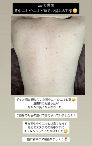 ベラージュ【美背中・ 美尻・フェイシャル】のエステ・リラクイメージ