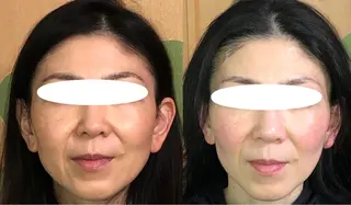 春日井トータルからだ サロンふくふくのエステ・リラクイメージ