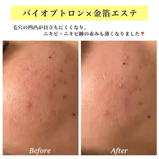 Bellesthe （ベルエステ）のエステ・リラクイメージ