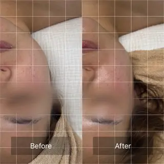 AmeliLab所属・Fujimoto Erinaの眉毛・アイブロウイメージ