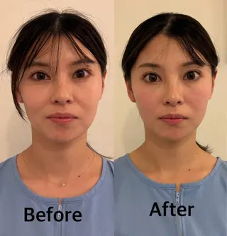 美容鍼灸サロン mahoroba院長のエステ・リラクイメージ