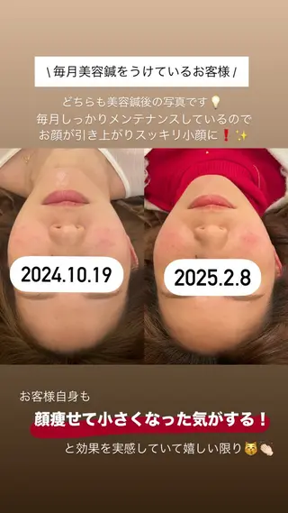 美容鍼/鍼灸 ここみ鍼灸院のエステ・リラクイメージ