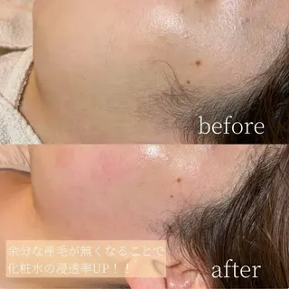 Erika komorebi_のエステ・リラクイメージ