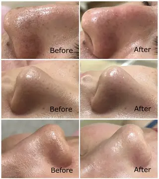 フェイシャル/脱毛 ジョアアンジェ竹田のエステ・リラクイメージ