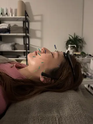美容鍼×小顔矯正 ×美容整体　浜川泰仁のエステ・リラクイメージ