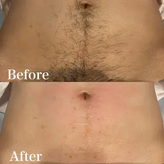 メンズ wax脱毛専門店 ハイラントのエステ・リラクイメージ