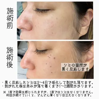 Red Moat所属・Red Moatのマツエク・マツパデザイン