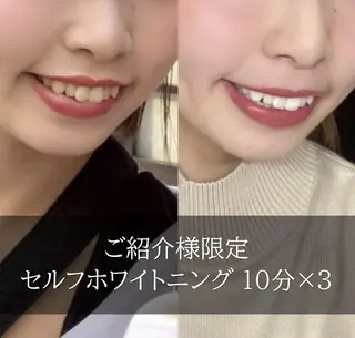 ホワイトニング専門店 LCS 銀座店 峰岡のその他イメージ