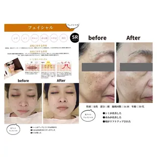 M's Style NAIL BARのエステ・リラクイメージ