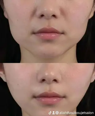 ネイル aliaハイフ&水光ジェットサロン所属・aliaハーブ水光店 エステティシャン募集のエステ・リラクイメージ