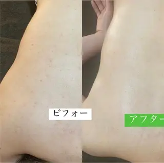 Dahlia所属・Dahlia ダリアのエステ・リラクイメージ