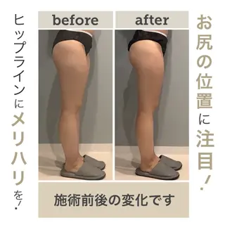 エステサロン JURISのエステ・リラクイメージ