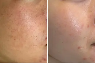 中澤 夢華のエステ・リラクイメージ