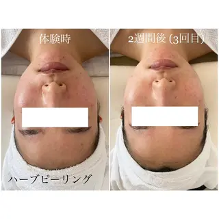 I'm -ｲﾑ-所属・肌質改善／ブライダル I'm.-イム-のエステ・リラクイメージ