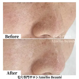 毛穴ケア専門サロン Amélio Beauté所属・毛穴ケア専門サロン アメリオボーテのその他イメージ