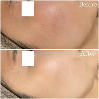 etes (エトエス)所属・etes.tokyo 中目黒のエステ・リラクイメージ