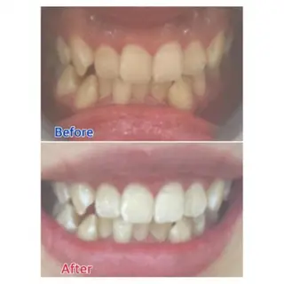 M渋谷店所属・Ｍ渋谷 ホワイトニングのエステ・リラクイメージ