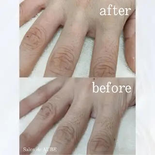 電気脱毛 Salon de AUBEのエステ・リラクイメージ