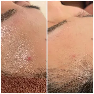 セミロング カラー パーマ ヘアアレンジ メンズ キッズ ネイル マツエク・マツパ アイブロウ ニキビ特化型エステ 🍓最短で肌質改善のエステ・リラクイメージ