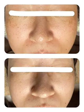 TIERRA(ティエラ)所属・TIERRA ♡のエステ・リラクイメージ