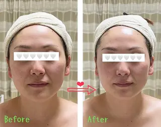 糸島 エステサロンmiuのエステ・リラクイメージ