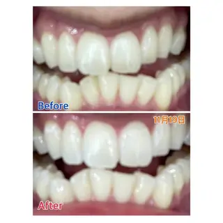 MBEAUTYSALON 千葉店・京成大久保所属・Melty 輝のその他イメージ